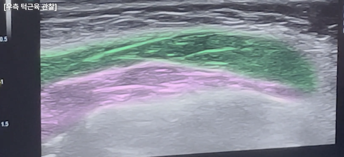 74378e13ee74896f787396d44146c77d_1769571097_6646.png 74378e13ee74896f787396d44146c77d_1769571097_6646.png