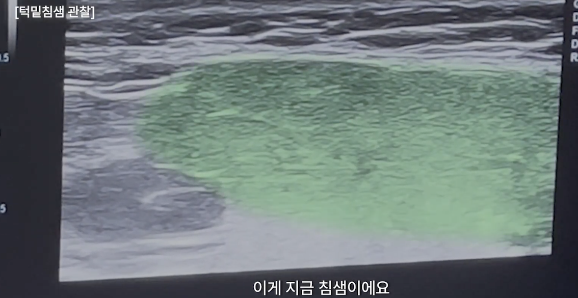 74378e13ee74896f787396d44146c77d_1769573918_228.png 74378e13ee74896f787396d44146c77d_1769573918_228.png