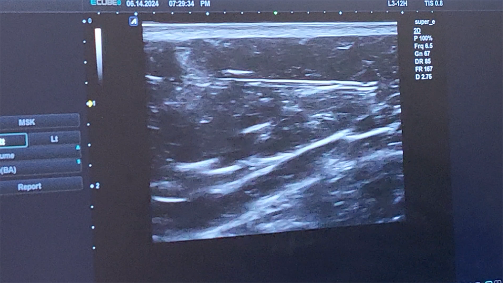 04ebd6ca957842fa4a102013e5c84383_1771908147_9652.png 04ebd6ca957842fa4a102013e5c84383_1771908147_9652.png